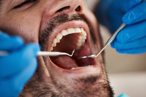 Best Chipped Tooth Repair Near Me  in Woodward, OK